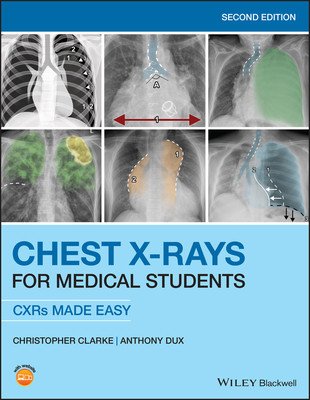 Chest X-Rays for Medical Students: Cxrs Made Easy (Clarke Christopher)(Paperback)