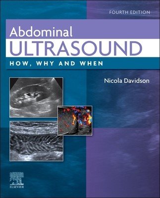 Abdominal Ultrasound: How, Why and When (Davidson Nicola)(Pevná vazba)
