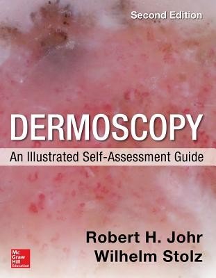 Dermoscopy: An Illustrated Self-Assessment Guide, 2/E (Johr Robert)(Paperback)
