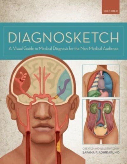 Diagnosketch: A Visual Guide to Medical Diagnosis for the Non-Medical Audience (Adhikari Sapana)(Spiral)