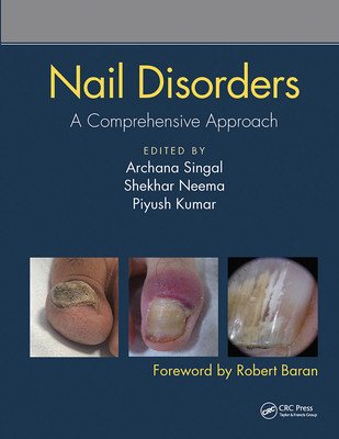 Nail Disorders: A Comprehensive Approach (Singal Archana)(Paperback)