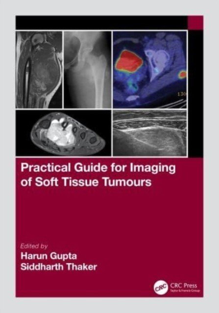 Practical Guide for Imaging of Soft Tissue Tumours (Gupta Harun)(Paperback)