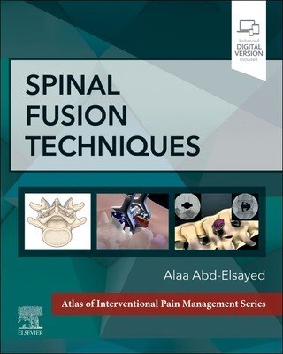 Spinal Fusion Techniques (Abd-Elsayed Alaa)(Pevná vazba)