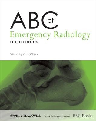 ABC of Emergency Radiology (Chan Otto)(Paperback)