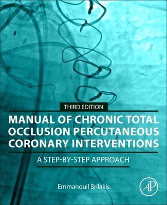 Manual of Chronic Total Occlusion Percutaneous Coronary Interventions: A Step-By-Step Approach (Brilakis Emmanouil)(Paperback)