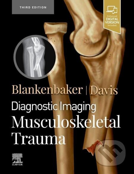 Diagnostic Imaging: Musculoskeletal Trauma - Donna G. Blankenbaker, Kirkland W. Davis