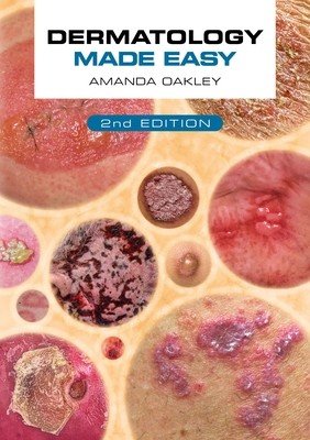 Dermatology Made Easy, Second Edition (Oakley Amanda)(Paperback)
