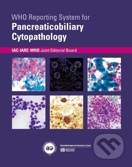 WHO reporting system for Pancreaticobiliary Cytopathology - World Health Organization