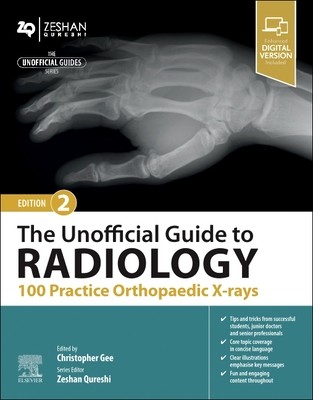 The Unofficial Guide to Radiology: 100 Practice Orthopaedic X-Rays (Gee Christopher)(Paperback)