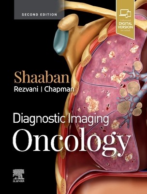 Diagnostic Imaging: Oncology (Shaaban Akram M. (Professor of Radiology Department of Radiology and Imaging Sciences University of Utah School of Medicine Salt Lake City Utah))(Pevná vazba)