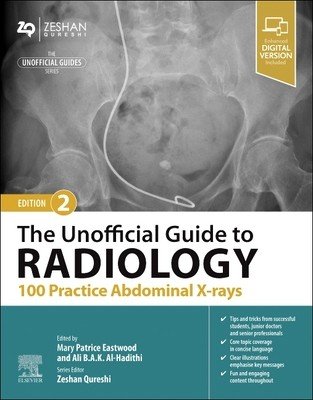 The Unofficial Guide to Radiology: 100 Practice Abdominal X-Rays (Eastwood Patrice)(Paperback)
