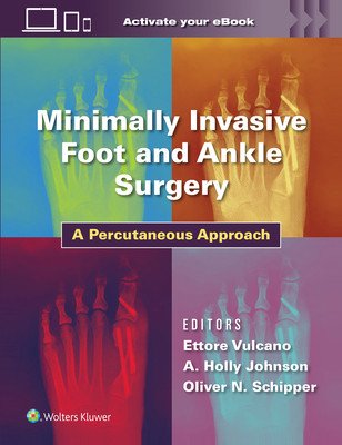 Minimally Invasive Foot and Ankle Surgery: A Percutaneous Approach (Vulcano Ettore)(Pevná vazba)