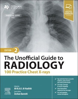 The Unofficial Guide to Radiology: 100 Practice Chest X-Rays (Al-Hadithi Ali B. a. K.)(Paperback)