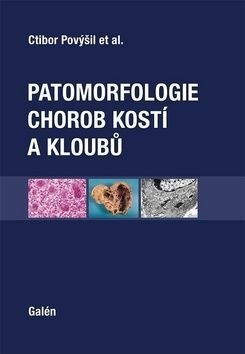 Patomorfologie chorob kostí a kloubů - Ctibor Povýšil