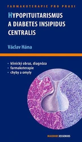 Hypopituitarismus a diabetes insipidus centralis - Hána Václav