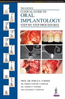 Clinical Guide to Oral Implantology: Step by Step Procedures (Turner Porus S.)(Paperback)