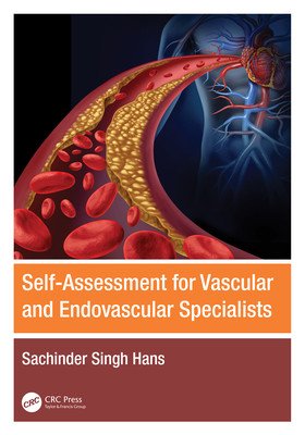 Self-Assessment for Vascular and Endovascular Specialists (Hans Sachinder Singh)(Paperback)