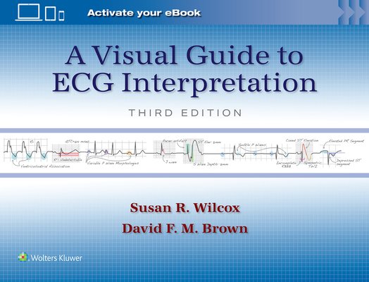 A Visual Guide to ECG Interpretation (Wilcox Susan Renee)(Paperback)
