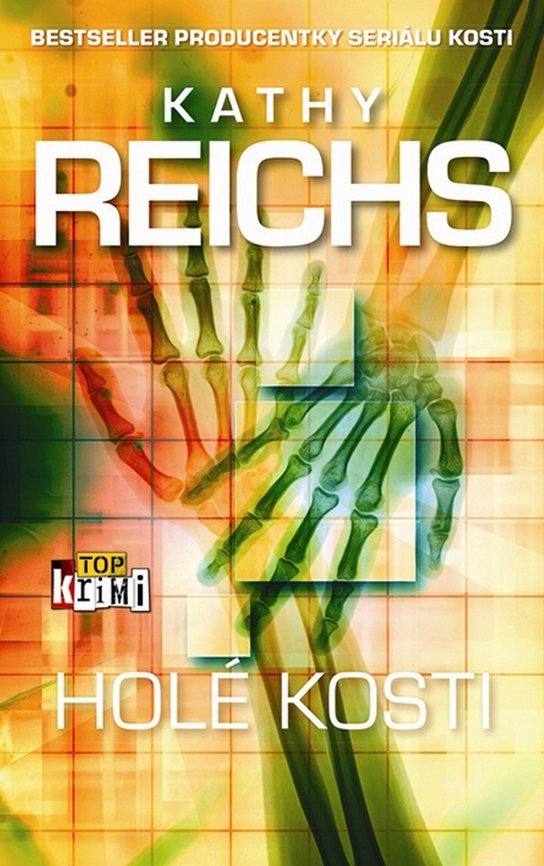 Holé kosti