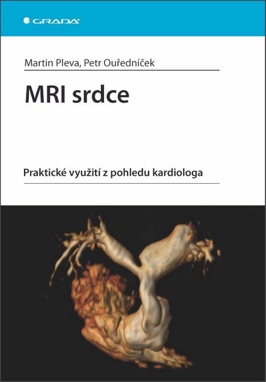 MRI srdce