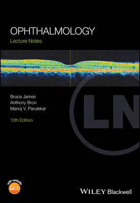 Ophthalmology - Lecture Notes (James Bruce (Stoke Mandeville Hospital Aylesbury))(Paperback / softback)