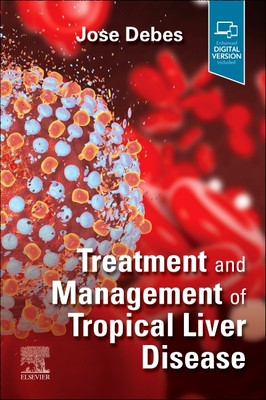 Treatment and Management of Tropical Liver Disease (Debes Jose)(Paperback)
