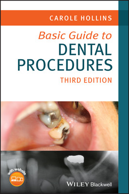 Basic Guide to Dental Procedures (Hollins Carole (British Dental Association))(Paperback / softback)
