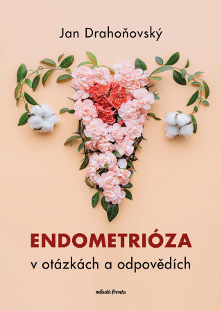 Endometrióza v otázkách a odpovědích - e-kniha