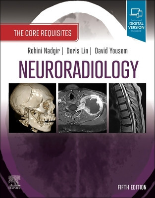 Neuroradiology: The Core Requisites (Nadgir Rohini)(Paperback)