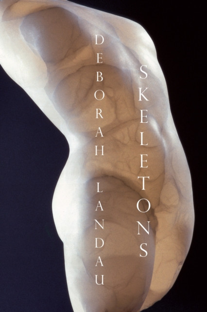 Skeletons (Landau Deborah)(Paperback / softback)
