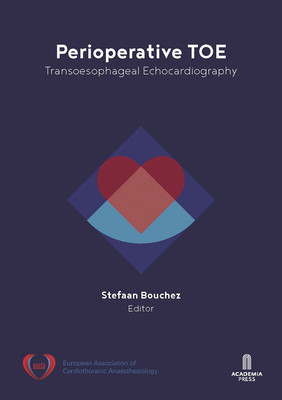 Perioperative Toe: Transoesophageal Echocardiography (Bouchez Stefaan)(Paperback)