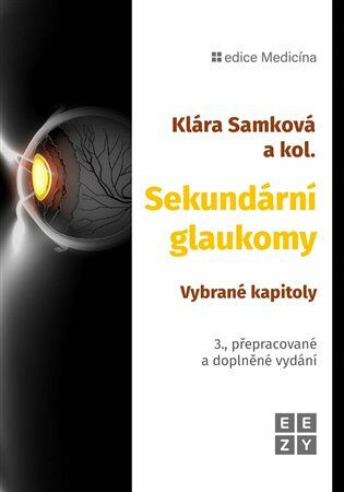 Sekundární glaukomy - Klára Samková