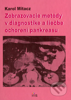 Zobrazovacie metódy v diagnostike a liečbe ochorení pankreasu - Karol Mitacz