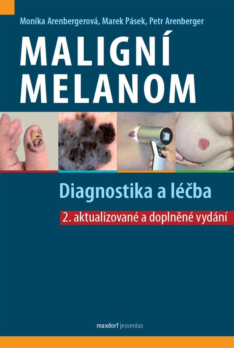 Maligní melanom - Diagnostika a léčba, 2.  vydání - Monika Arenbergerová