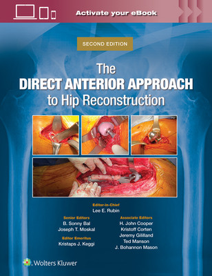 The Direct Anterior Approach to Hip Reconstruction (Rubin Lee E.)(Pevná vazba)