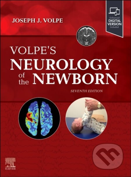 Volpe's Neurology of the Newborn - Joseph J. Volpe, Terrie E. Inder