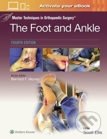 Master Techniques in Orthopaedic Surgery: The Foot and Ankle - Scott Ellis