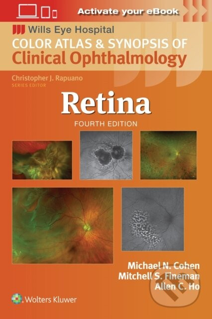 Retina - Mitchell S. Fineman