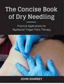 Concise Book of Dry Needling - A Practitioner's Guide to Myofascial Trigger Point Applications (Sharkey John)(Paperback / softback)