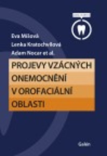 Otorinolaryngologie a foniatrie: Repetitorium - Zdeněk Voldřich