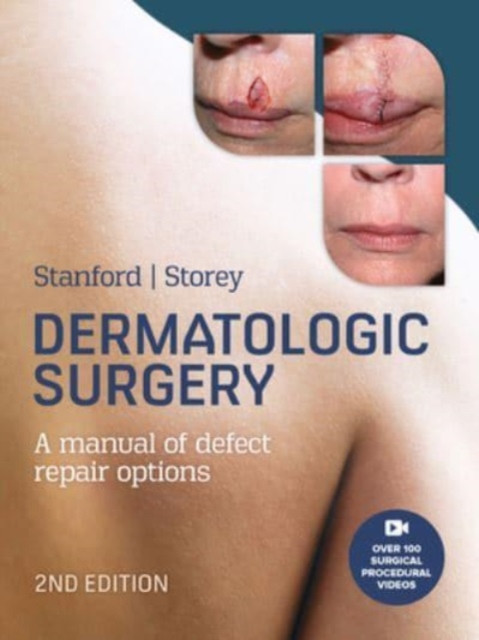 Dermatologic Surgery (Stanford Duncan)(Pevná vazba)