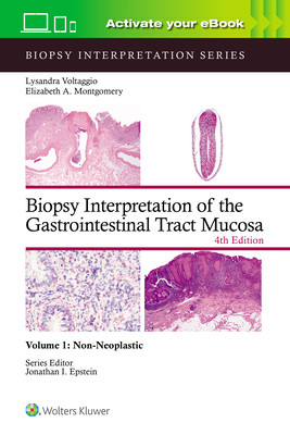 Biopsy Interpretation of the Gastrointestinal Tract Mucosa Volume 1: Non-Neoplastic: Print + eBook with Multimedia Volume 1 (Voltaggio Lysandra)(Pevná vazba)
