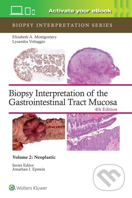 Biopsy Interpretation of the Gastrointestinal Tract Mucosa Volume 2 : Neoplastic - ELIZABETH ANNE MONTGOMERY, Lysandra Voltaggio