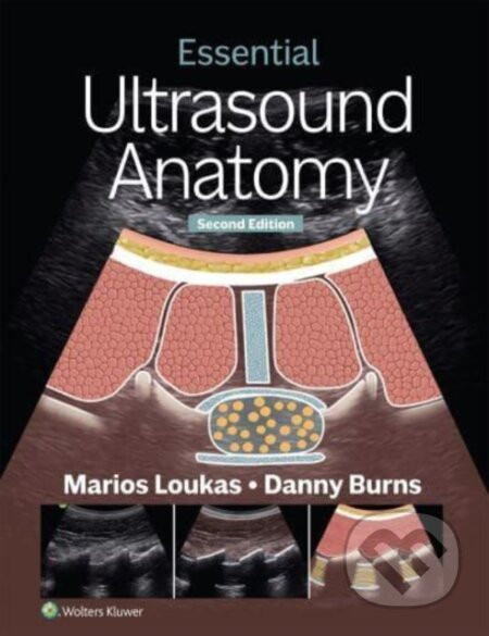 Essential Ultrasound Anatomy - Danny Burns, Marios Loukas