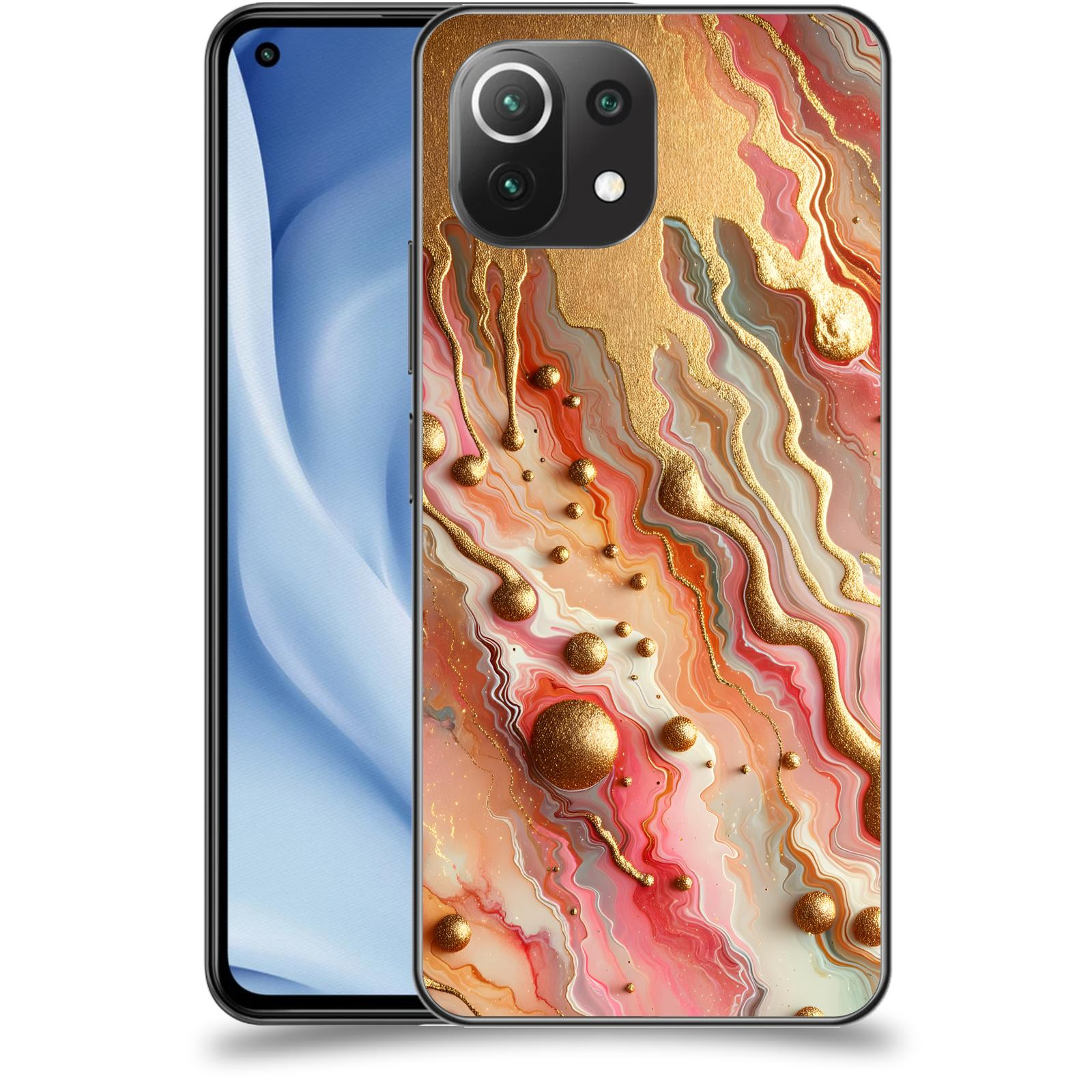 ACOVER Kryt na mobil Xiaomi Mi 11 Lite - Liquid Gold
