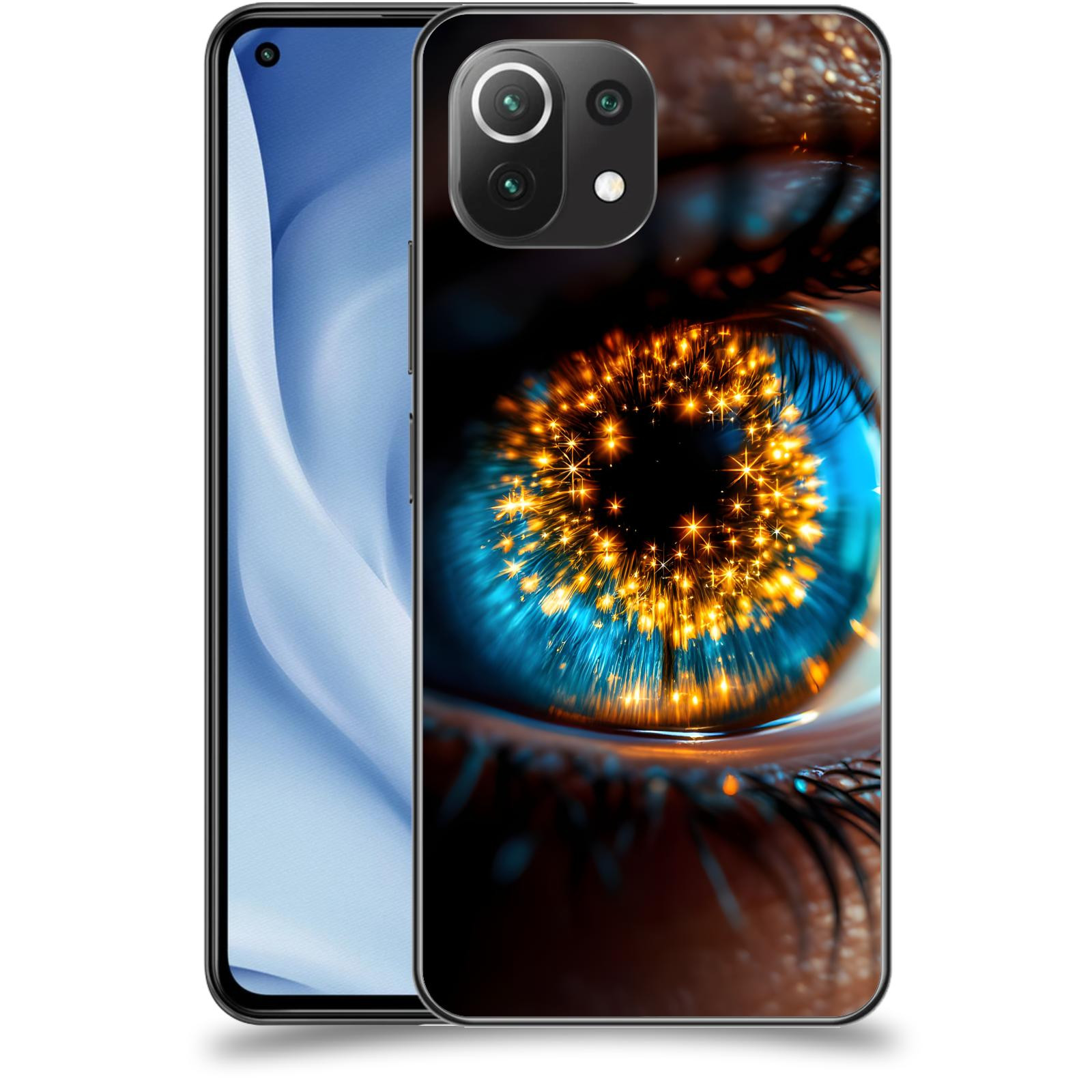 ACOVER Kryt na mobil Xiaomi Mi 11 Lite - Sparkle in the eye