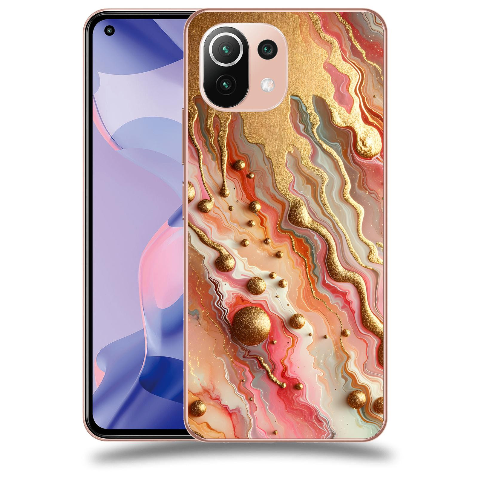 ACOVER Kryt na mobil Xiaomi 11 Lite 5G NE - Liquid Gold