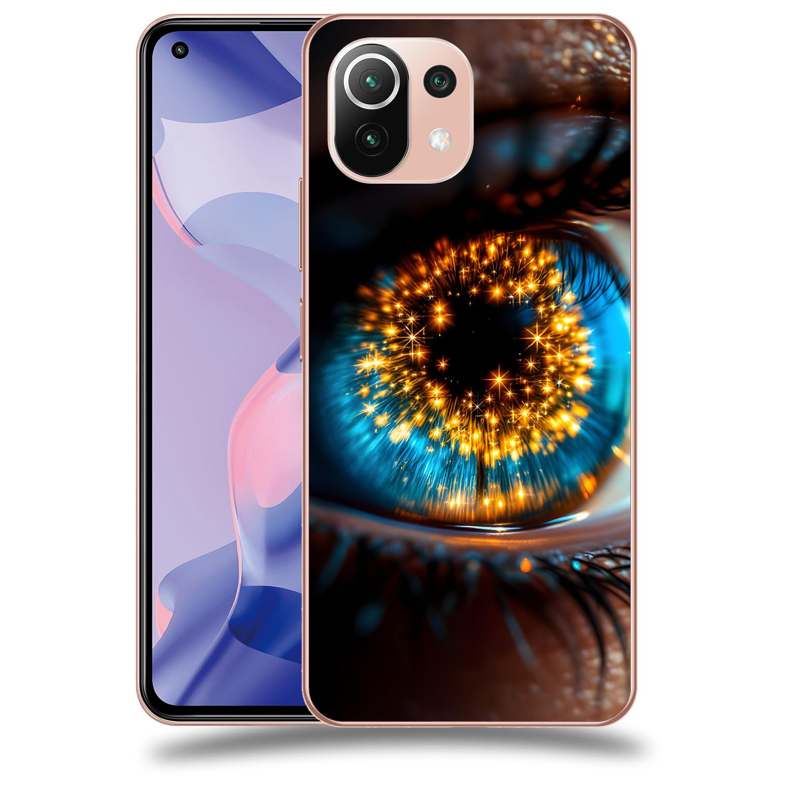 ACOVER Kryt na mobil Xiaomi 11 Lite 5G NE - Sparkle in the eye