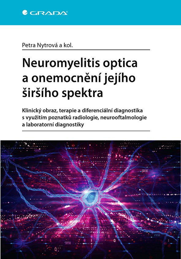 Kniha: Neuromyelitis optica a onemocnění jejího širšího spektra od Nytrová Petra