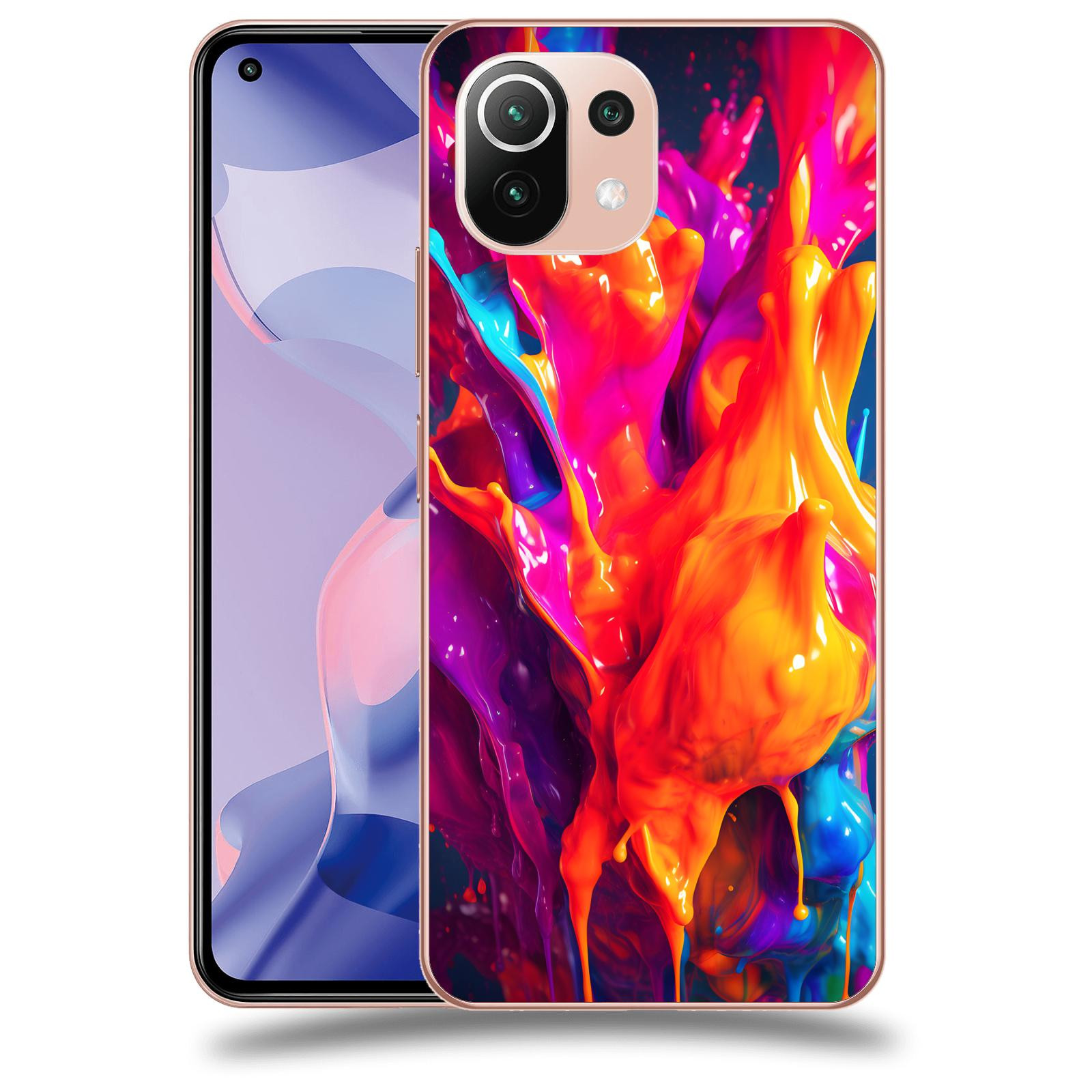 ACOVER Kryt na mobil Xiaomi 11 Lite 5G NE - Beautiful Liquid I